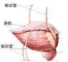 前列腺炎