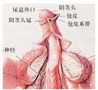 陰莖延長(zhǎng)